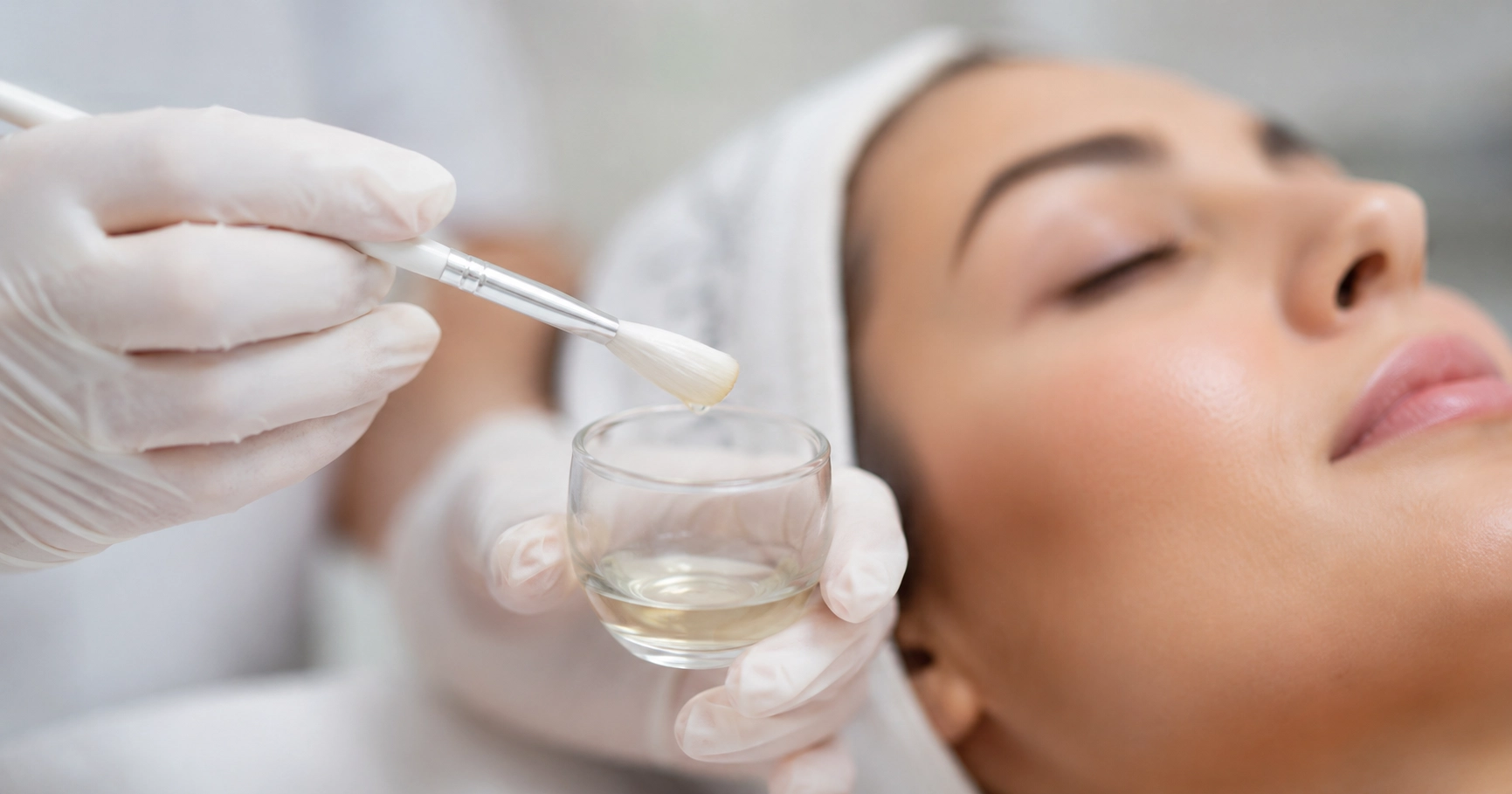 Peeling químico: o que é, tipos e para que serve
